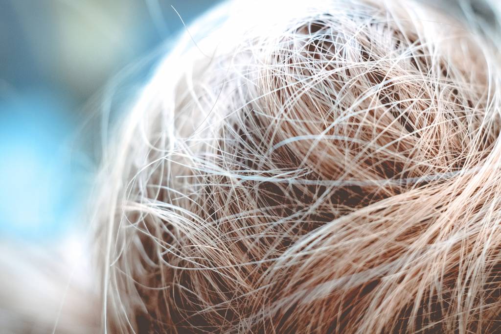 niklas-hamann-414707-unsplash