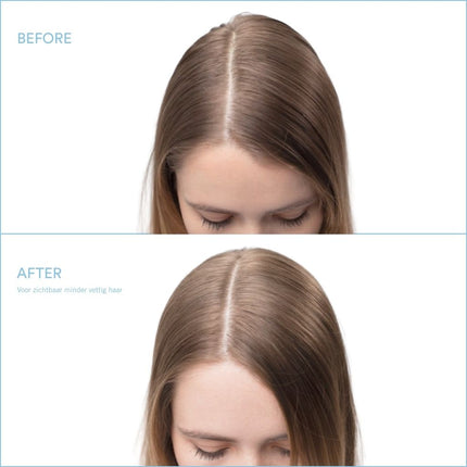 Fibre Clinix Scalp Clinix Oil Control Shampoo - 300ml