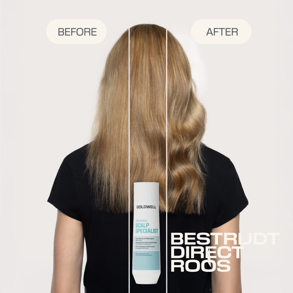 Goldwell Dualsenses Anti-Dandruff Scalp Care Duo