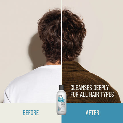KMS Hair Head Remedy Deep Cleanse Shampoo