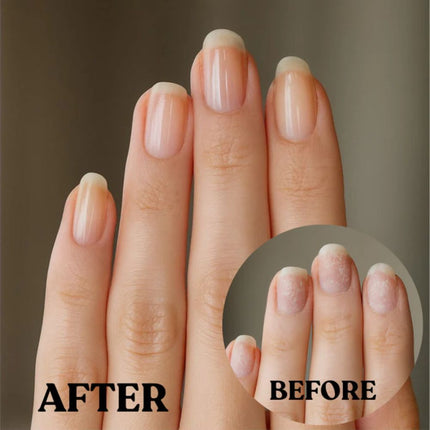 Maniac 5-Day Recovery Treatment - 8ml