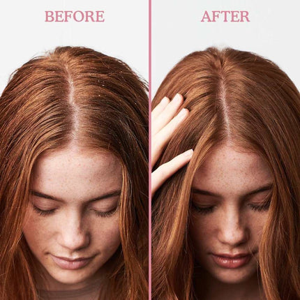 Umberto Giannini Exfoliating Anti-Dandruff Scalp Scrub - 200ml