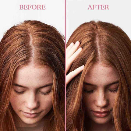 Umberto Giannini Scalp Restore Reviving Anti-Dandruff Conditioner - 250ml